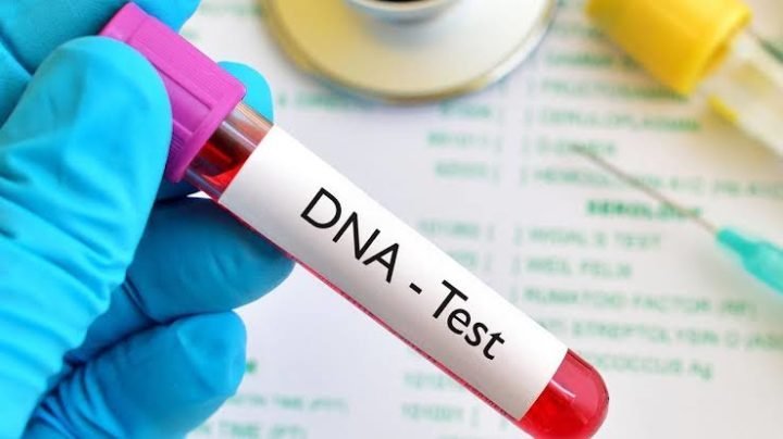DNA test